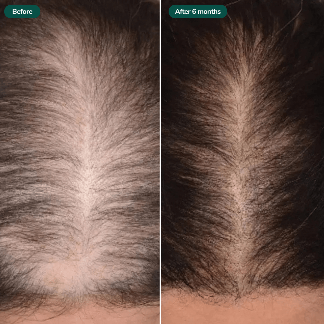 Strawberry Regrowth Gummies